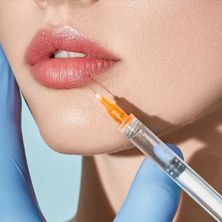 Lip Filler - 0.5ml at Unique Clinique Aesthetics in Brooklyn, NY