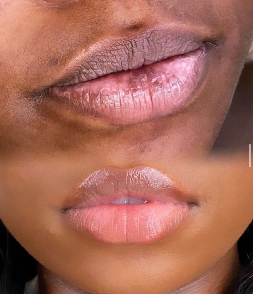 Datk Lip Neutralization