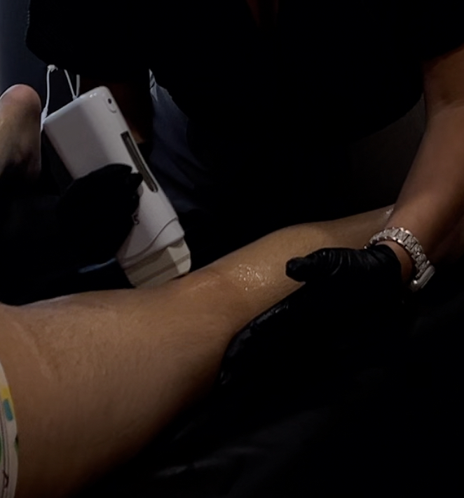 Upper Leg