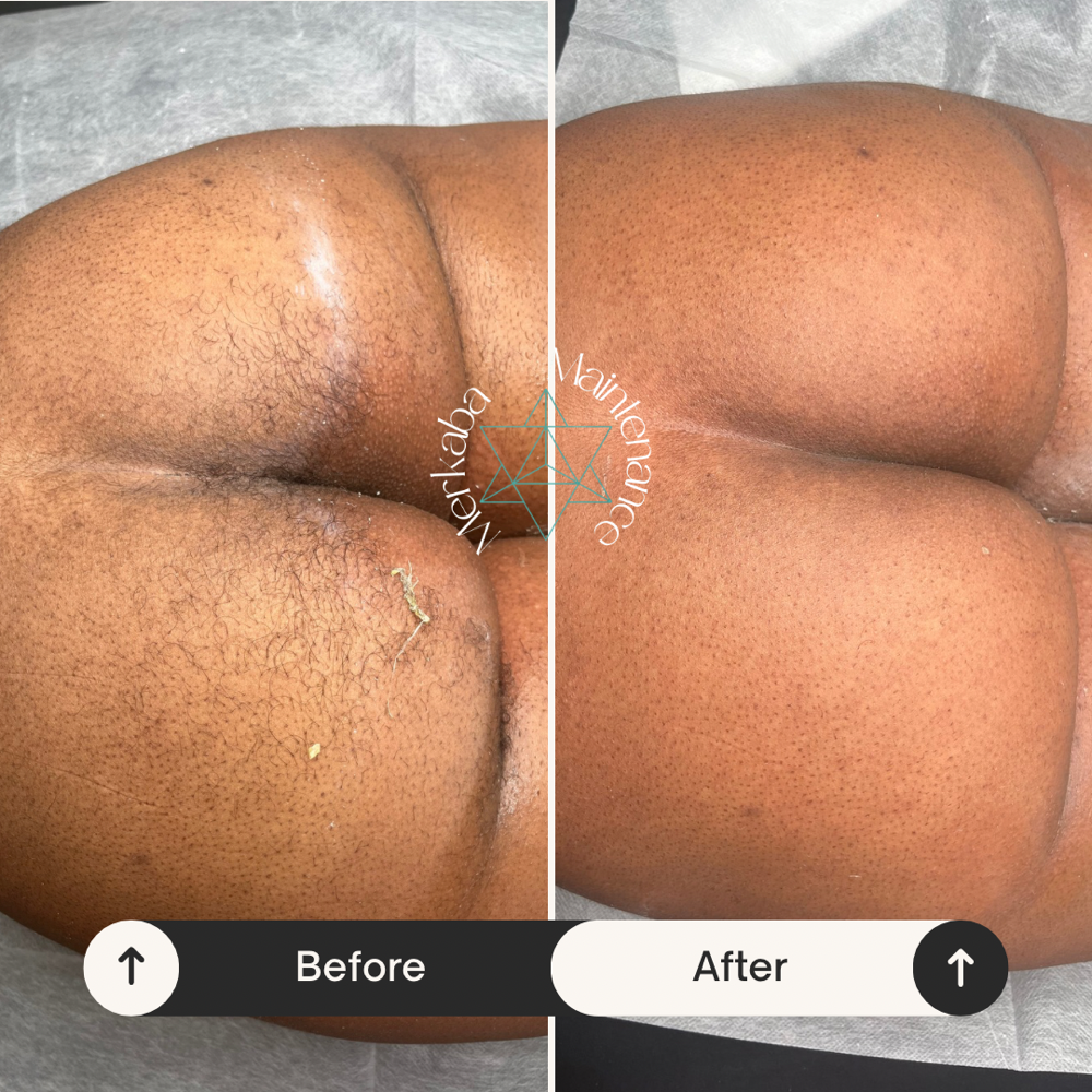 Buttocks Wax