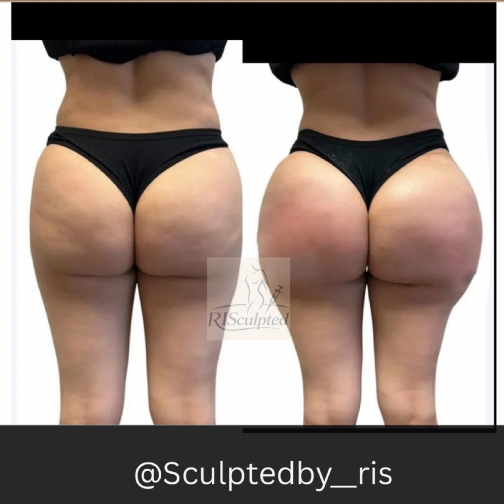 The “Vixen” Doll (800ml) at RISculpted Aesthetics in Stockbridge, GA