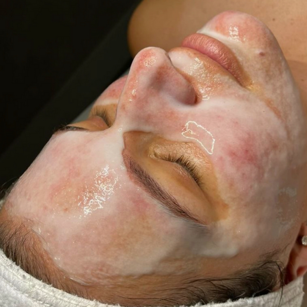 Oxygen Facial at Mia Sol Esthetics in Wayne, NJ