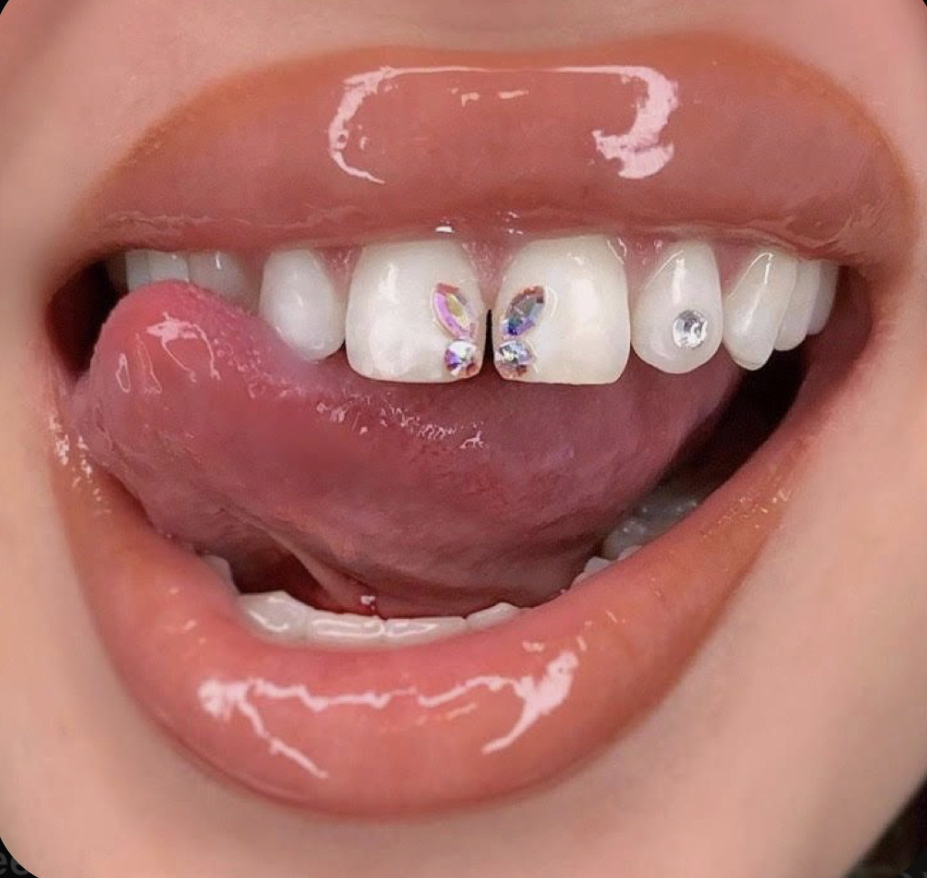 Buterfly Tooth Gem