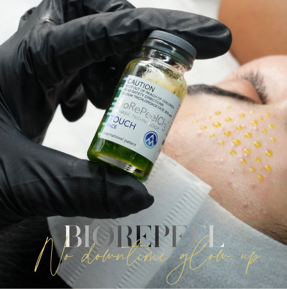 BioRePeel® Revitalizing Peel at Vogetica Beauty Lab (Regina) in Dallas, TX