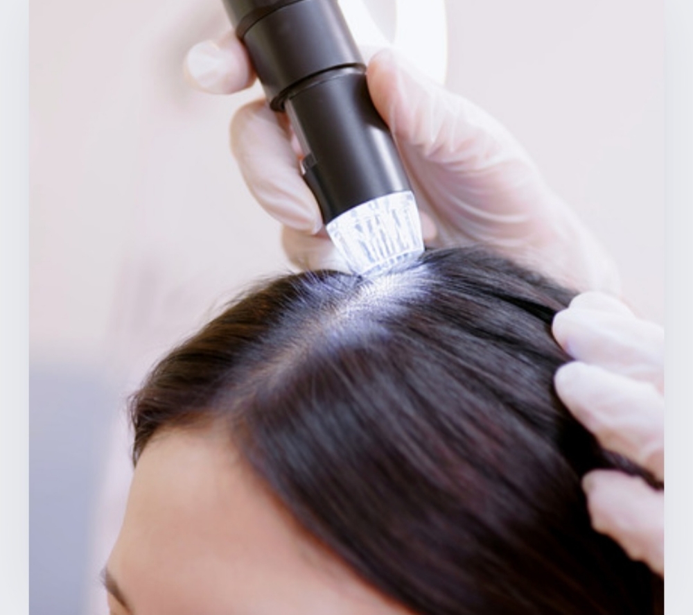 Scalp & Hair Treatment + Blowdry