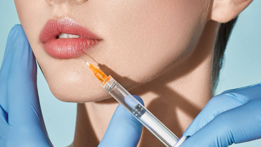 Lip Filler