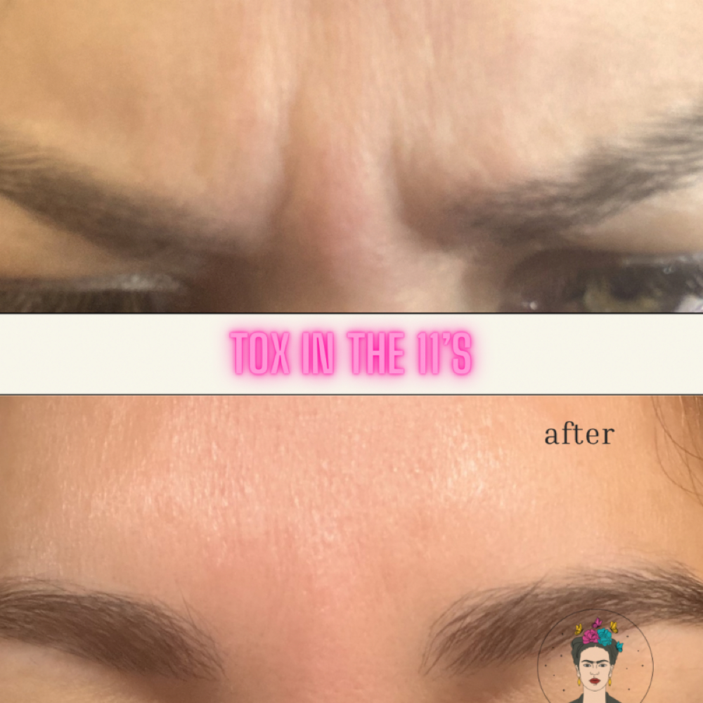 Forehead & 11’s Combo at Booking site for Mely & Kaila in Lubbock, TX