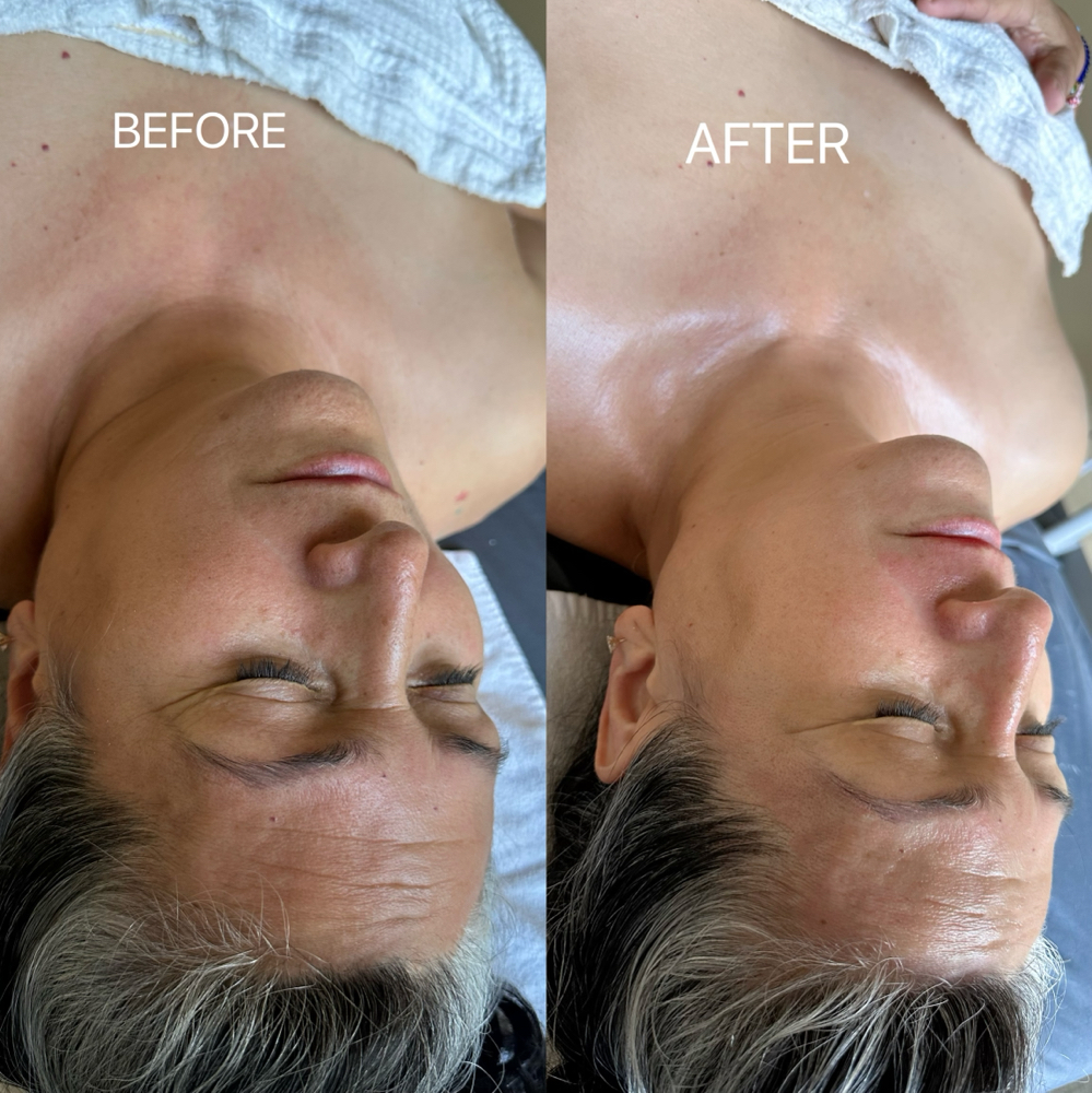 FACIALS 💆🏽‍♀️ at My Dream Beauty Bar in Yorkville, IL