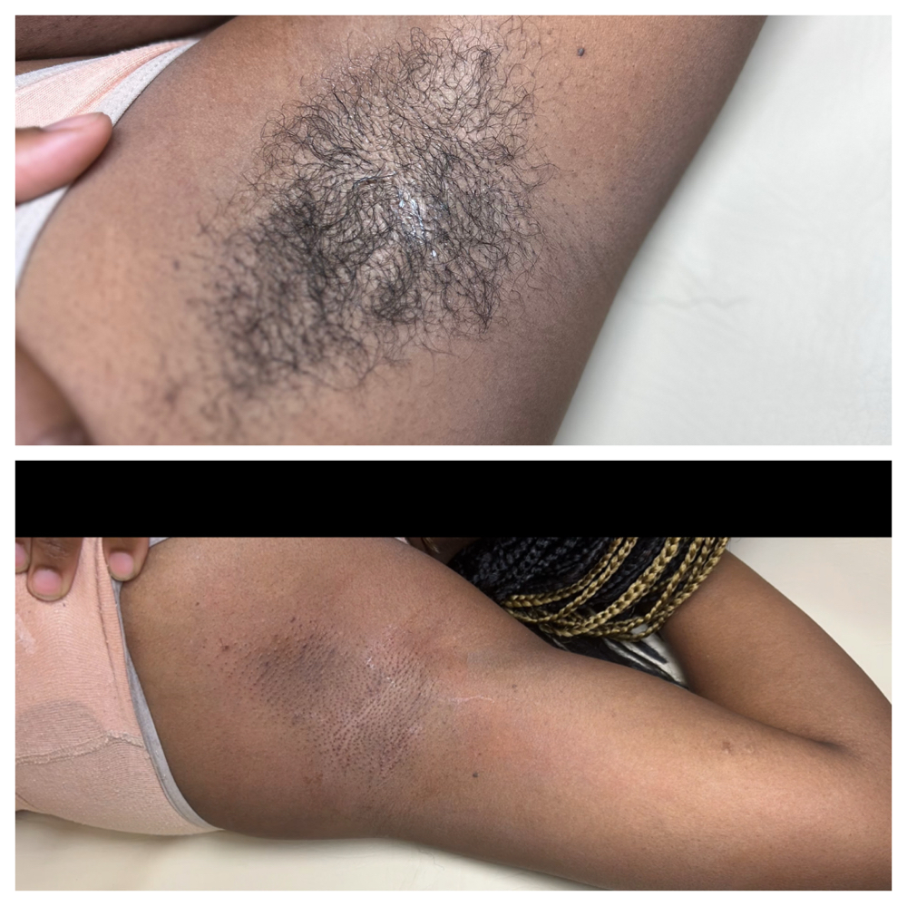 Underarm Wax at Rhealm in Charlotte, NC