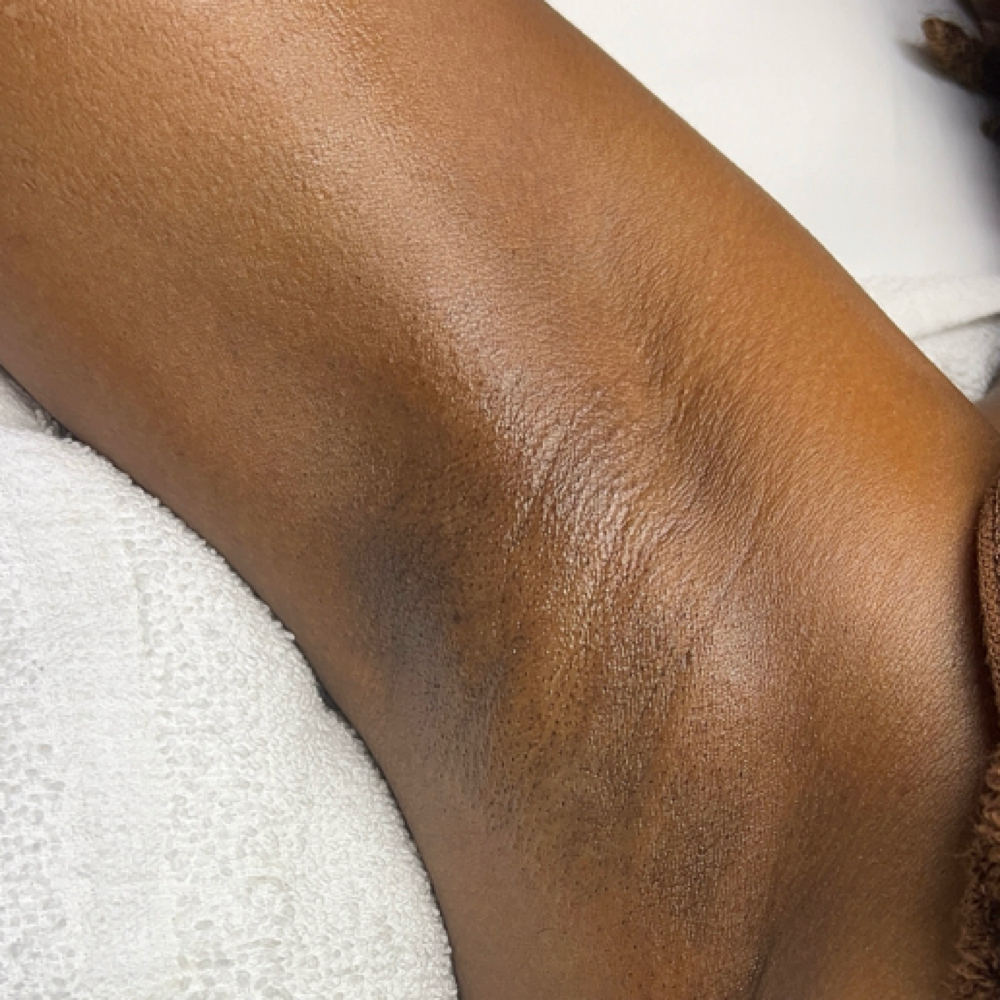 Underarm Wax at Rhealm in Charlotte, NC