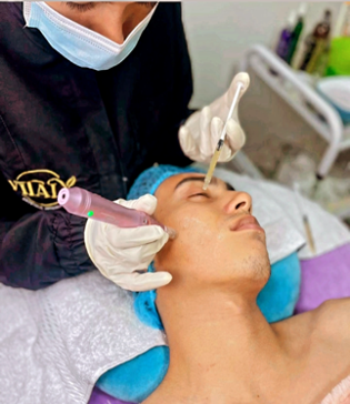 Facial Nutrition + Microneedling at Vitaly Beauty Secret in Miramar, FL
