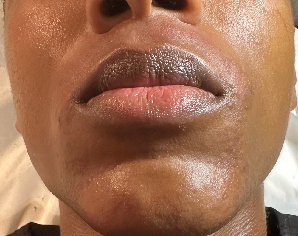 FACE (M)