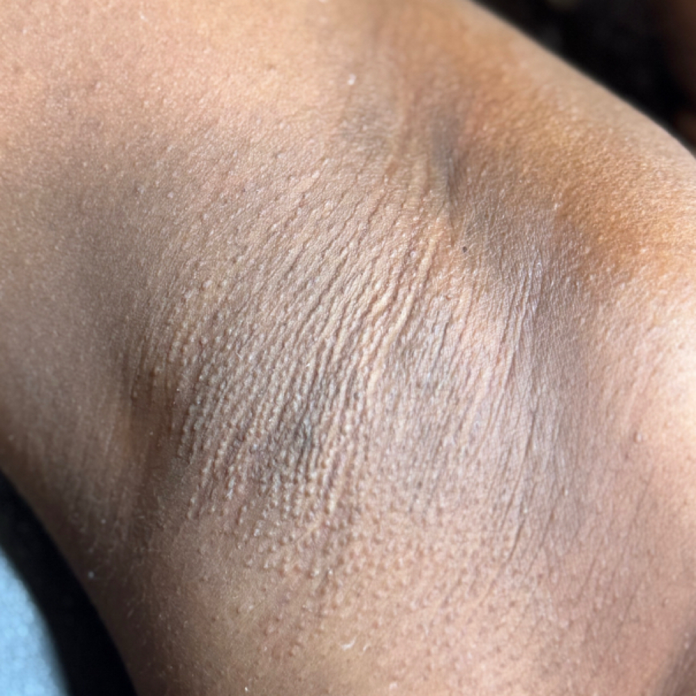 Underarm Wax at Your Skin by M in College Park, MD