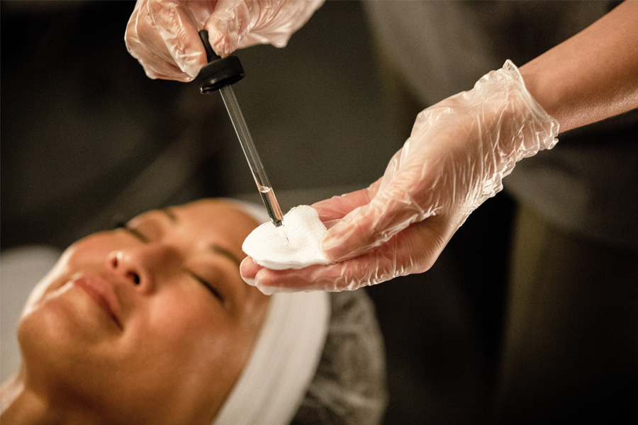 Chemical Peel Consult