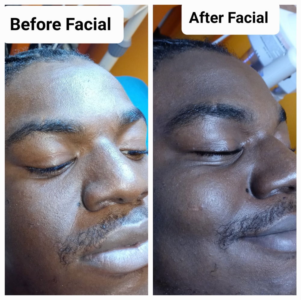 DETOX FACIAL