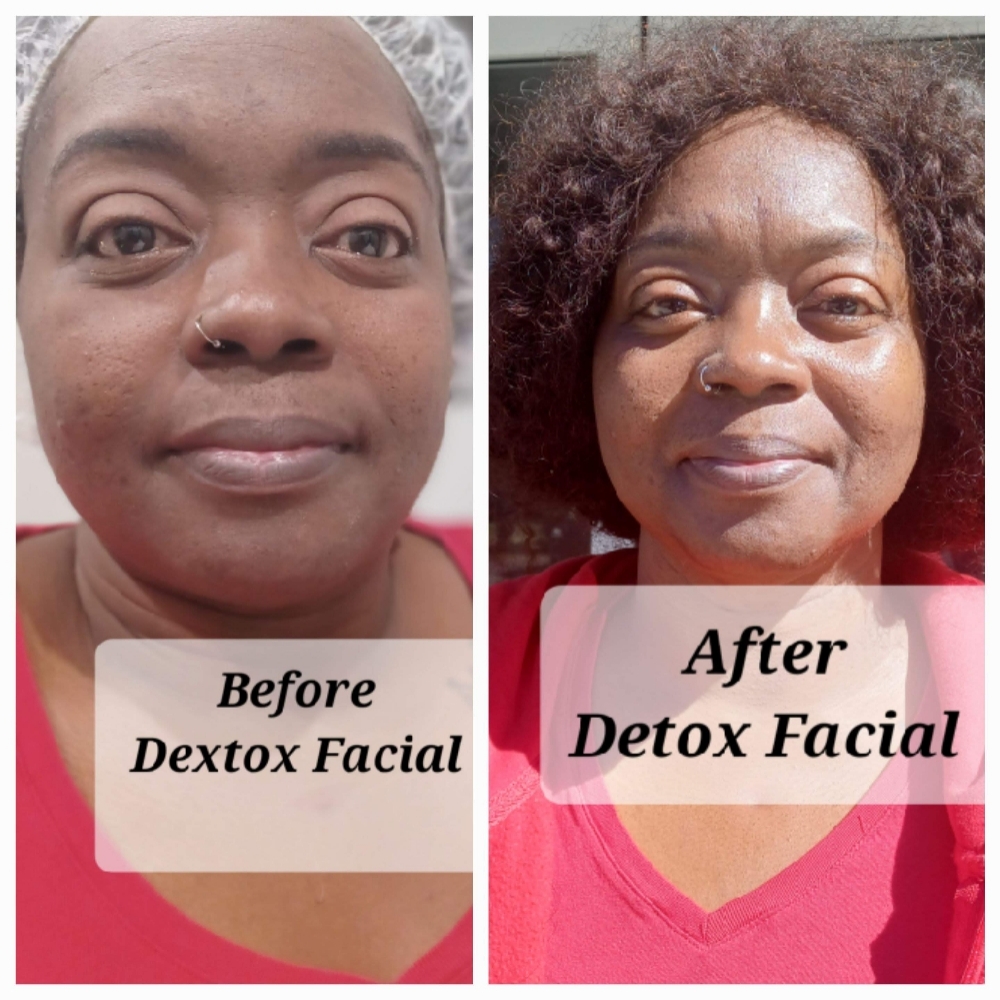 Detox Facial at JUST BEAUTIFUL SKIN in Goose Creek, SC