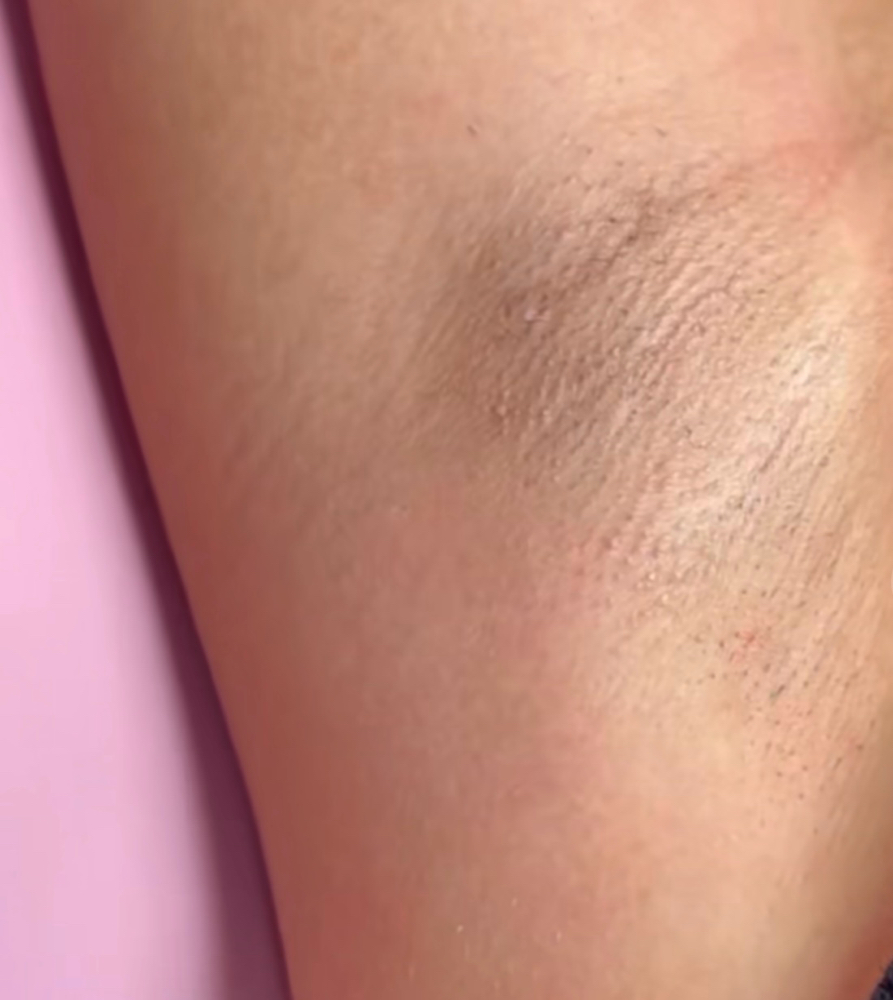Underarm