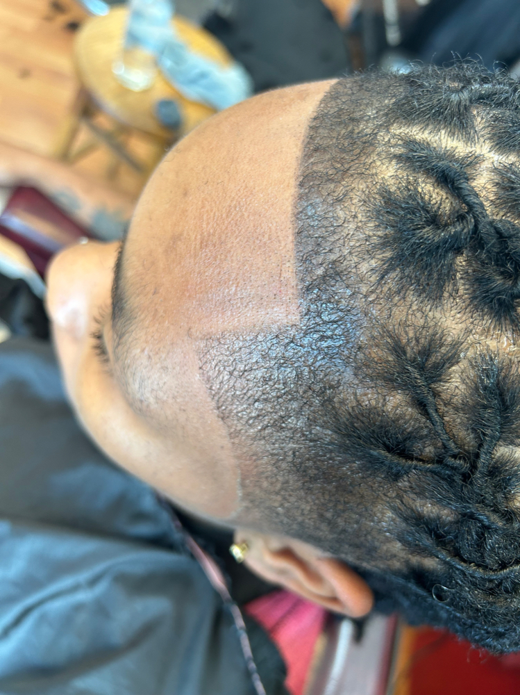 Hairline Enhancement