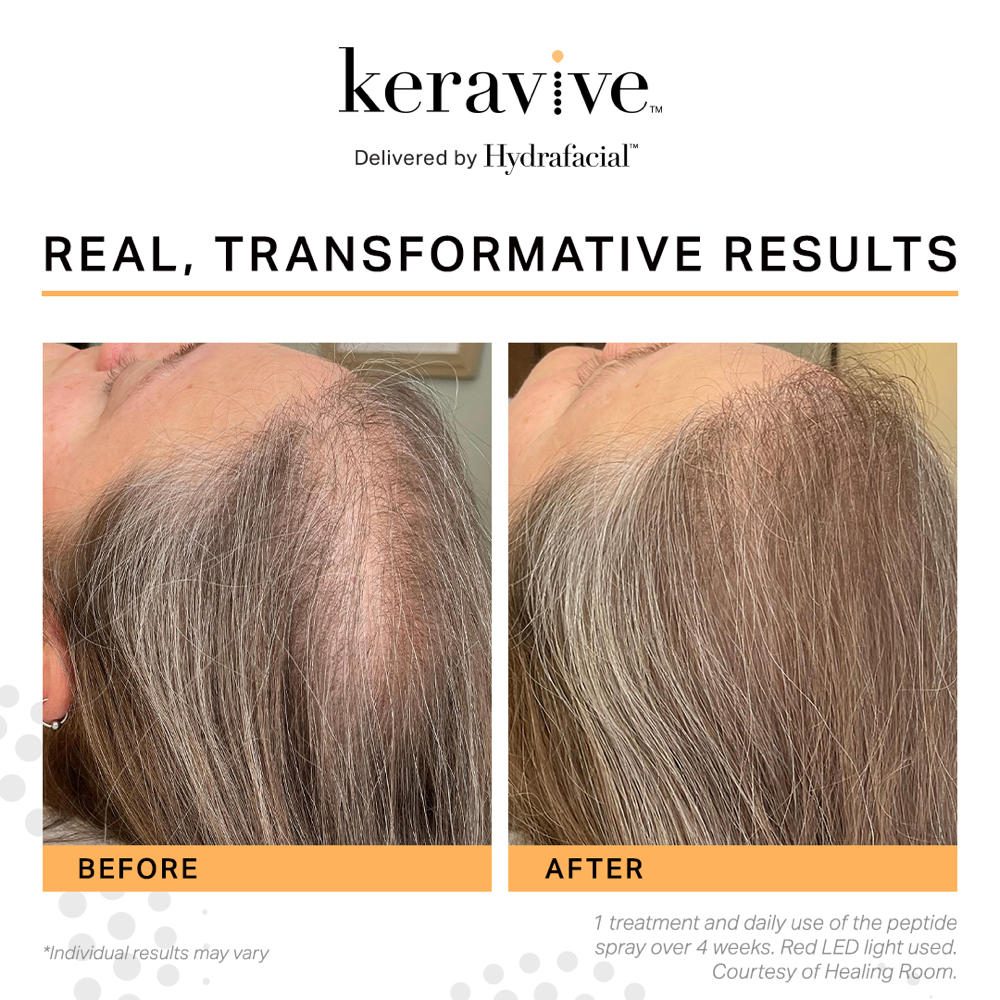 3 Keravive Scap Treatments