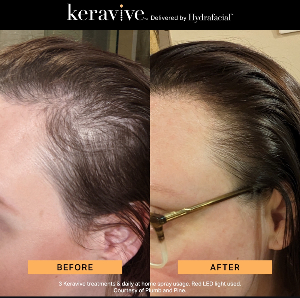 Keravive MD at Elysian by My Shaping Spa in San Diego, CA