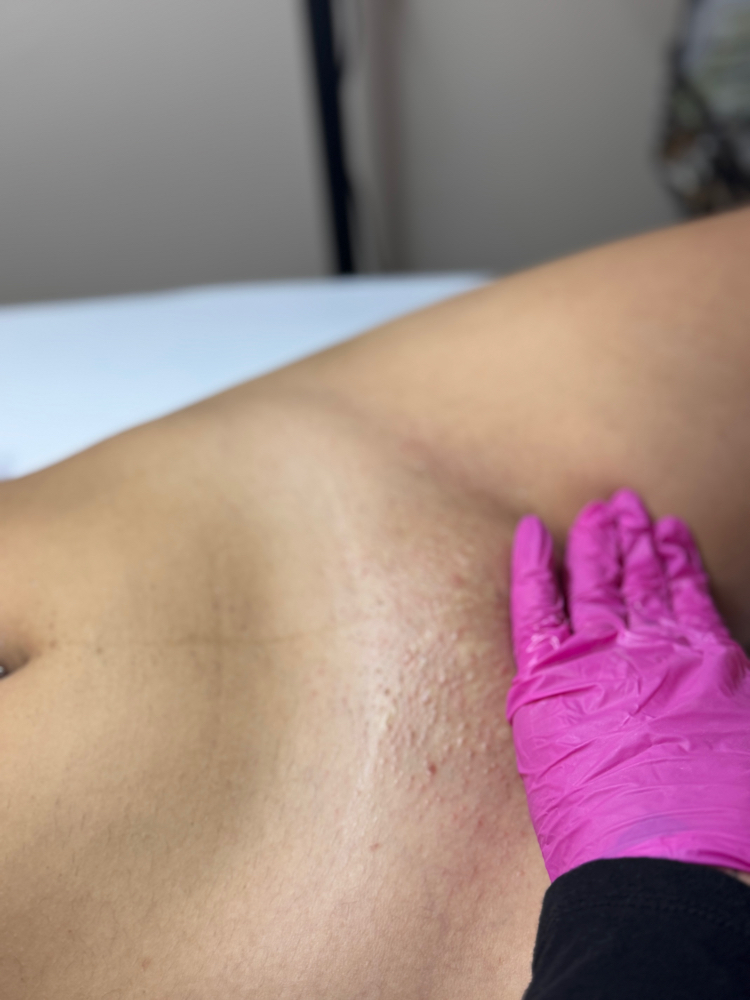 Brazilian Wax at KayLuxAesthetics in Fuquay-Varina, NC