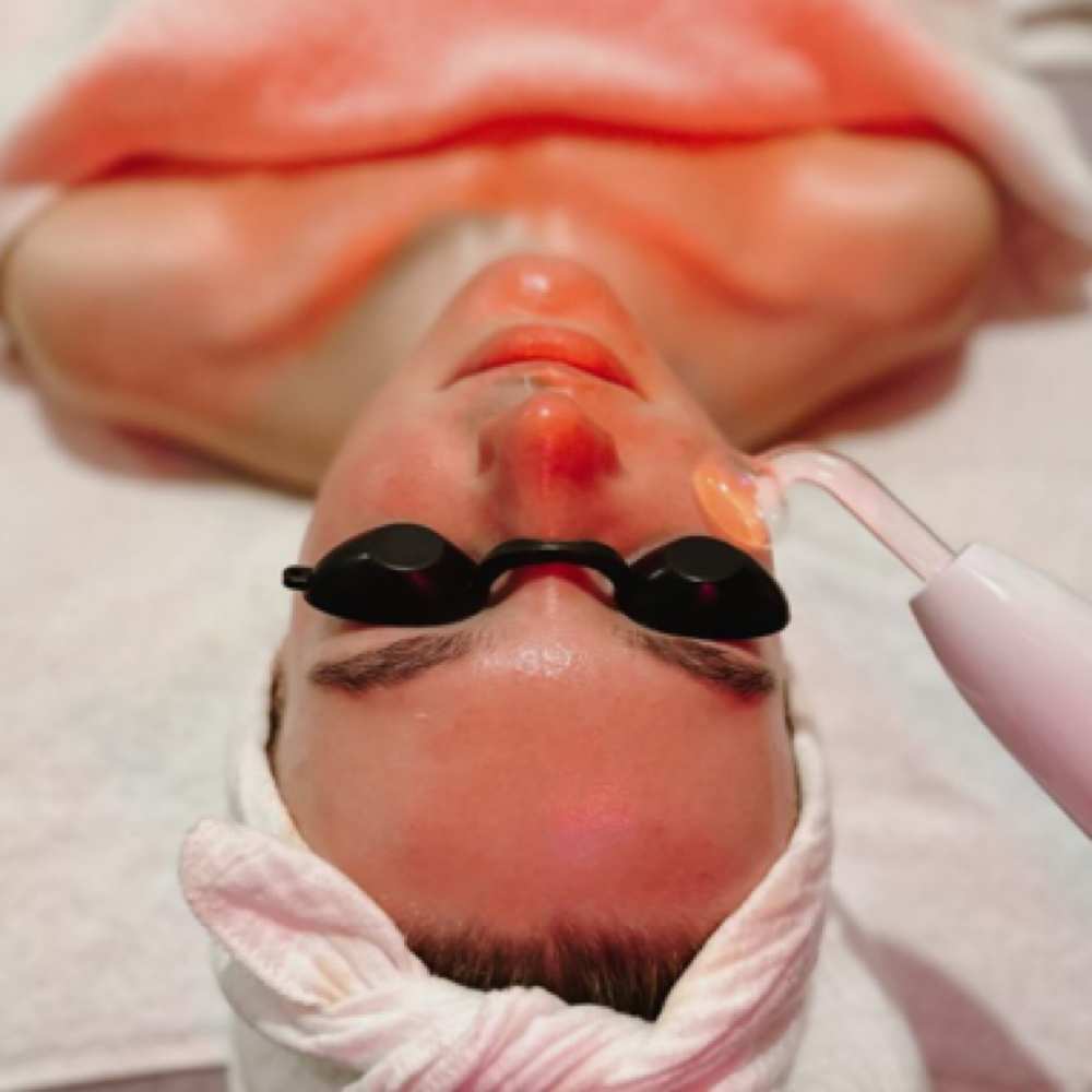 High Frequency Treatment (add on) at Doliveira Aesthetics in Cumberland, IN