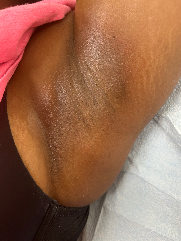 Under Arm Wax