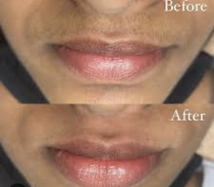 Upper Lip Wax