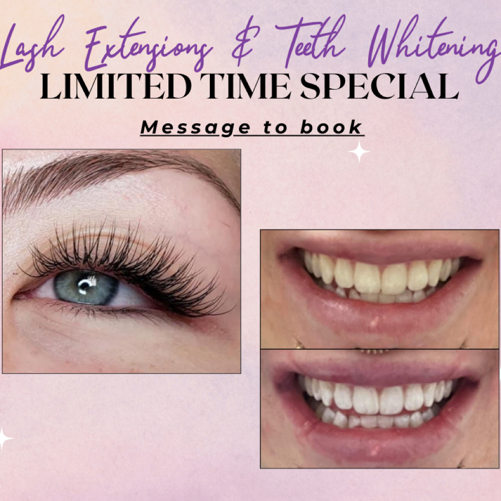 Lashes And Whitening Special at All That Lash QC in East Moline, IL