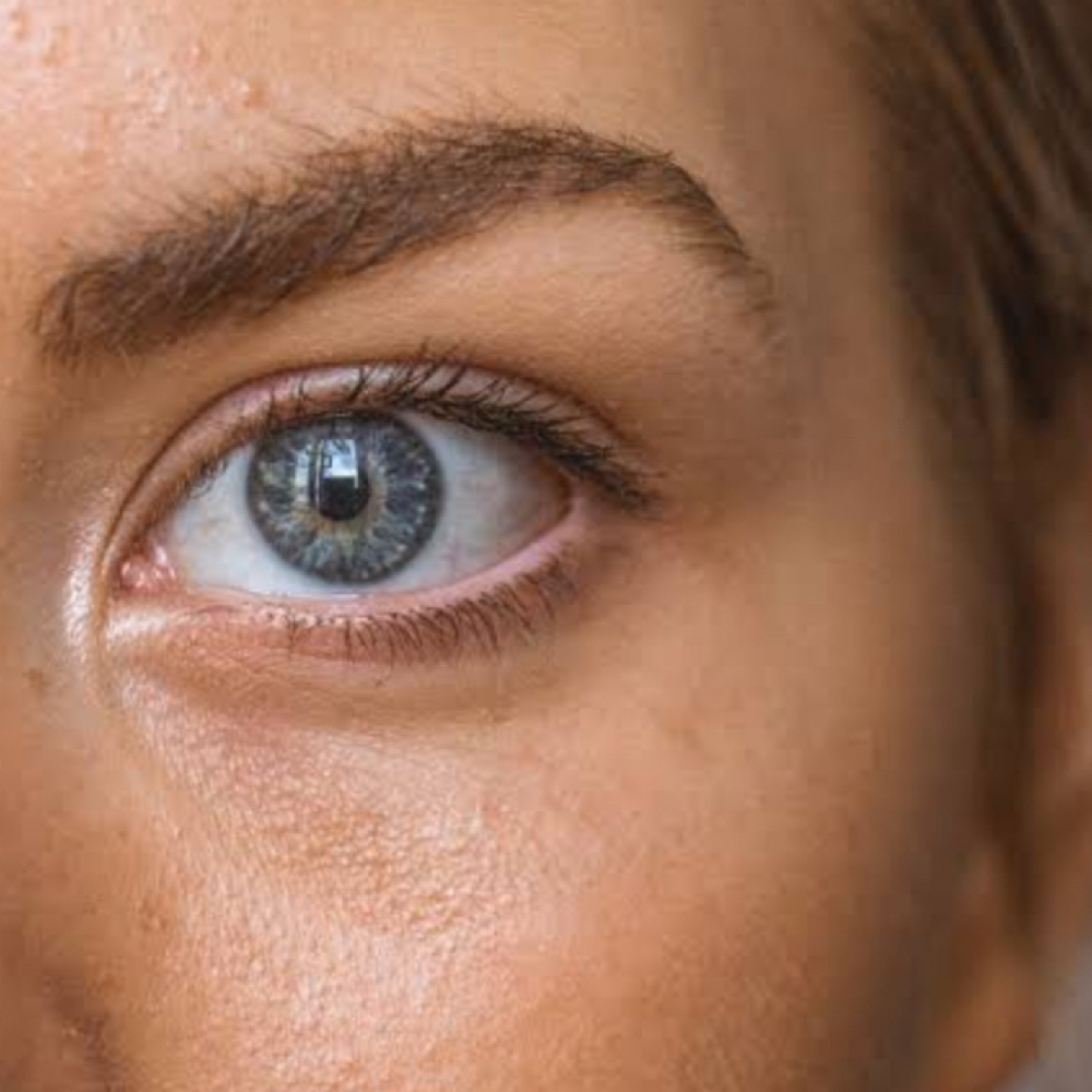 Under-Eye Rejuvenation at Luxehaus aesthetics & wellness by Cynthia Lucio in Bolingbrook, IL