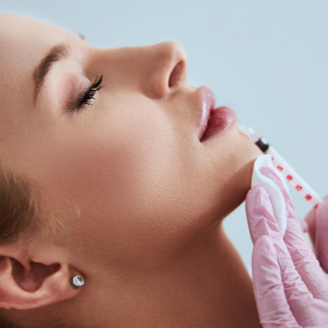 Restylane - Kysse at DM Laser Skin Care Solutions in Needham, MA