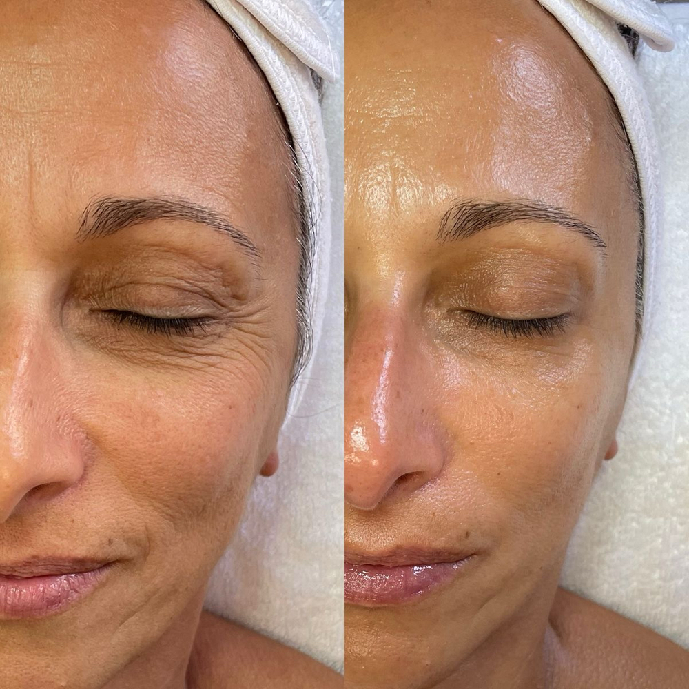 ANTI AGING FACIAL TREATMENT