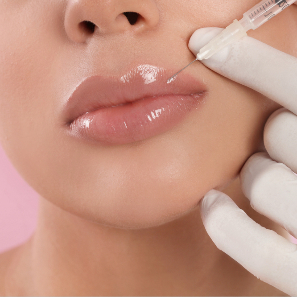 Lip Filler at Huda Aesthetics in Allen, TX