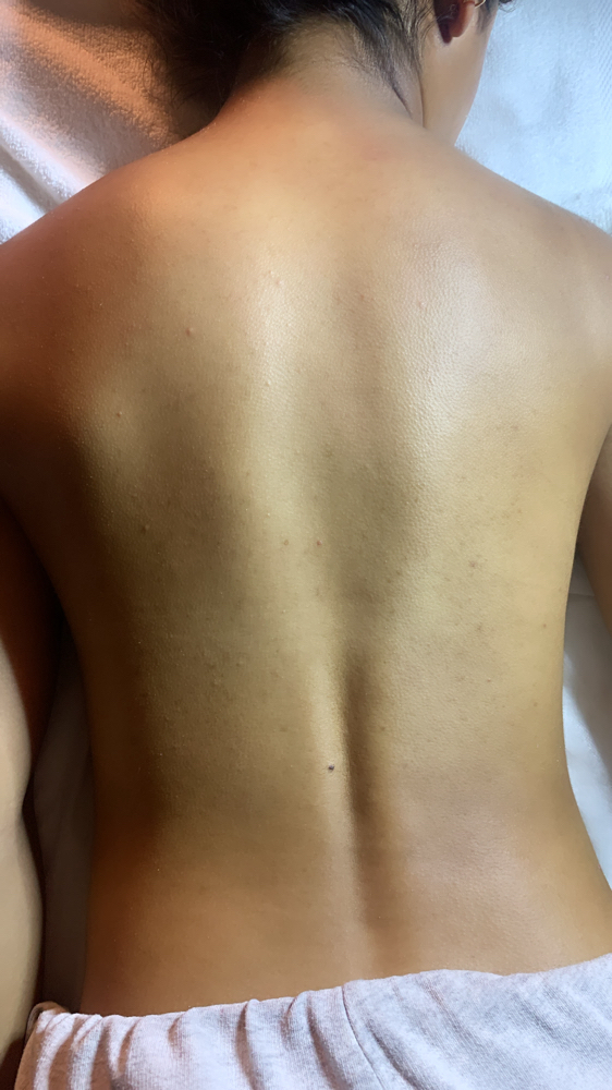 Back Facial