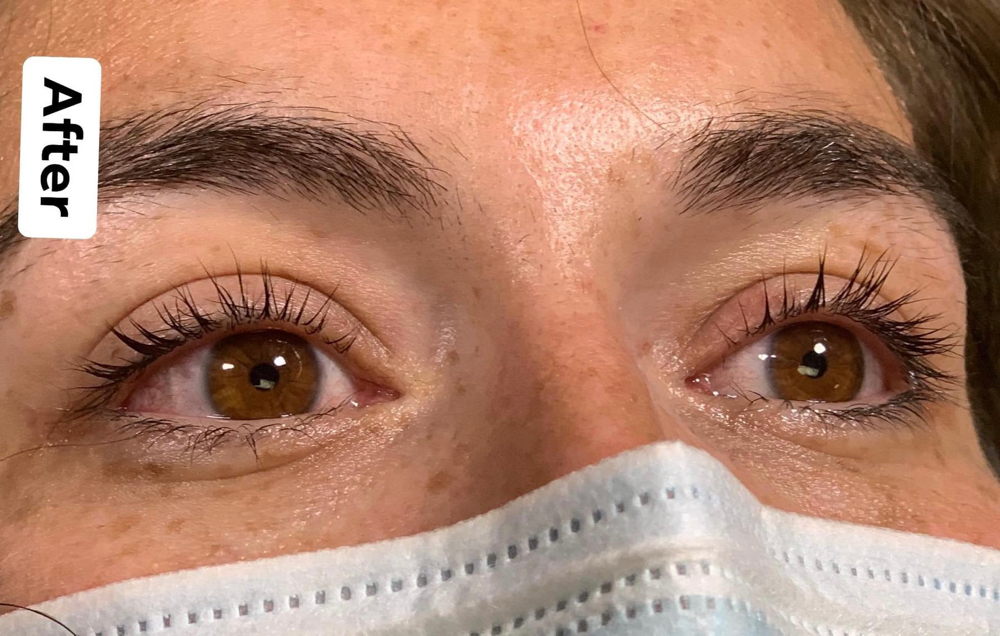 Lash Lift