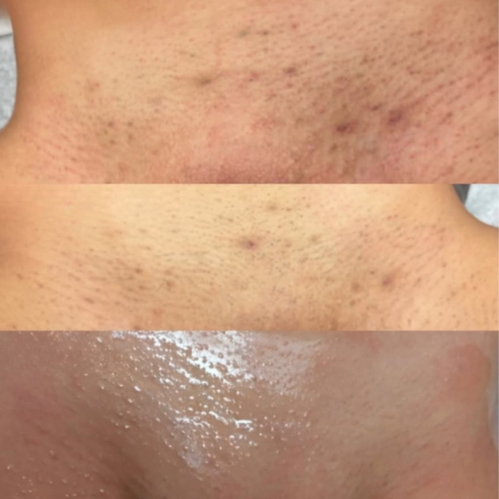 Oxy Vajacial Treatment at Kiara’s Glam Studio in KILLEEN, TX