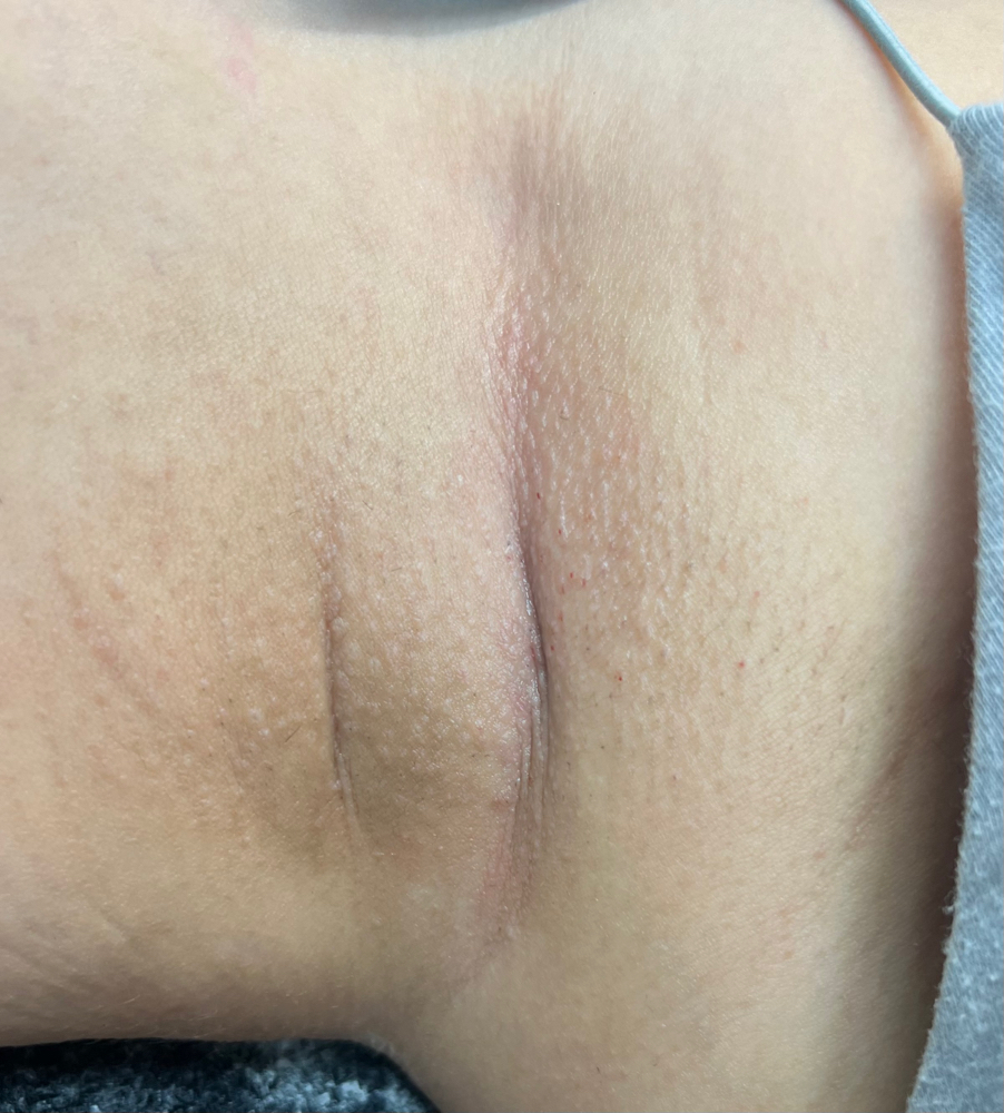 Underarm Wax