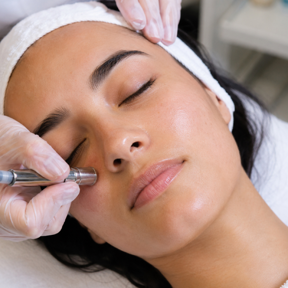Diamond Microdermabrasion at Stacey Carta Skin Care in Concord, CA