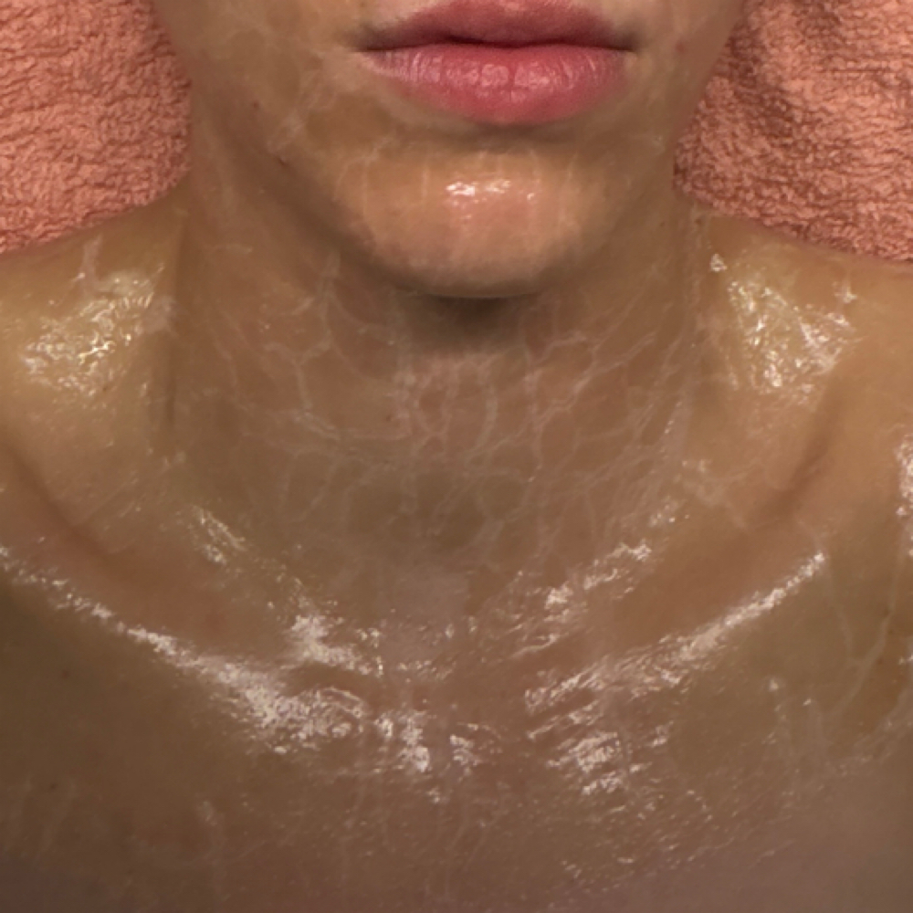 Beyond Botox Facial at AK Aesthetics in Downers Grove, IL