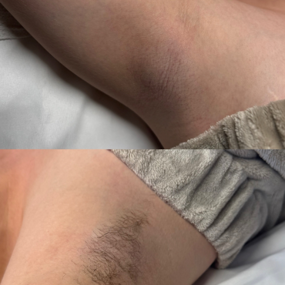 Underarm Wax at Kayla's Korner Esthetics in Taylorsville, KY