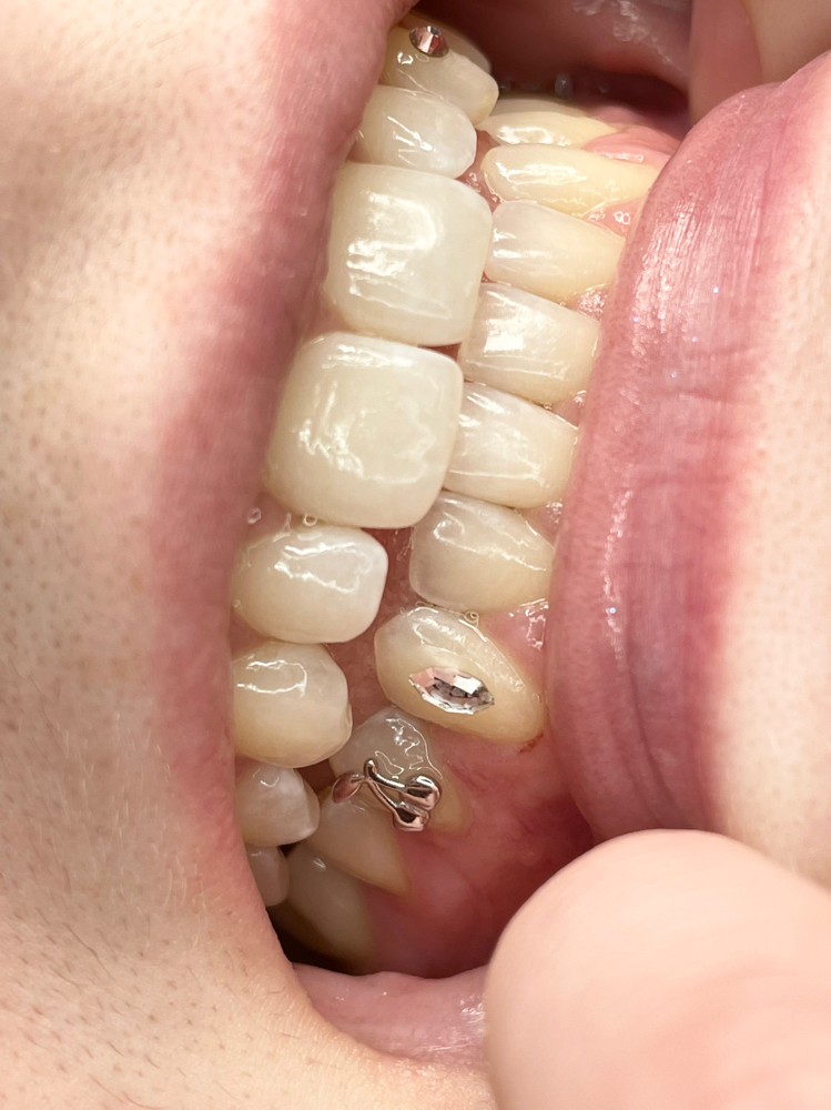 Tooth gems 2 Gems