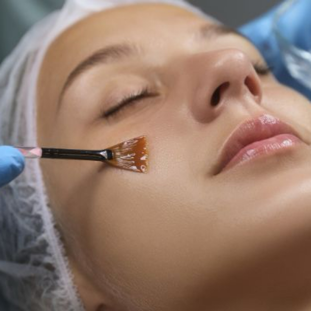 Chemical Peel at B. Rucker Beauty Co. in Hendersonville, TN
