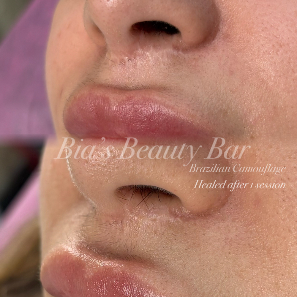 Brazilian Camouflage-Face Scar at Bia's Beauty Bar in Buffalo, NY