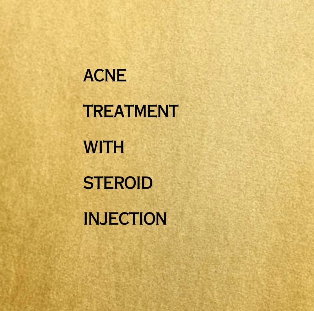 Acne Treatment With Steroid Inject