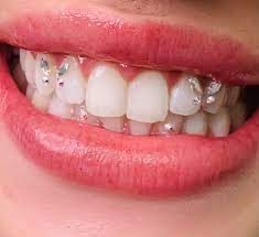 Butterfly Tooth Gemz