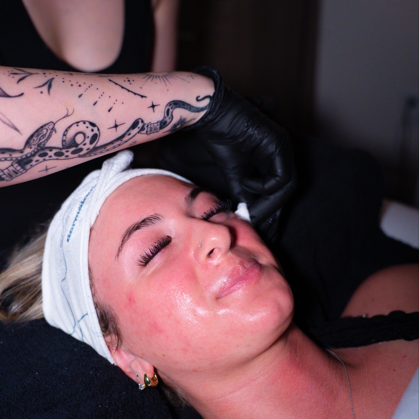 Glymed Hydrating Glycolic Peel at Healing Touch Esthetics in Port Jefferson Station, NY