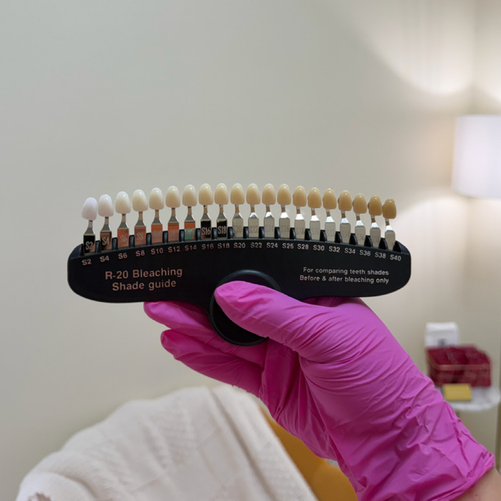 30-Minute Professional Teeth Whiten at Wax & Co. in Bossier City, LA