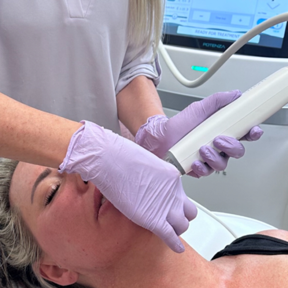 Radio Frequency Microneedling at Erika’s Beauty Lab in Littleton, CO