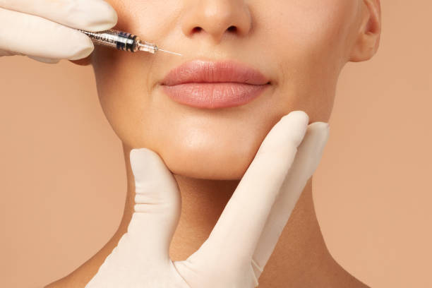 Lip Flip Neurotoxins