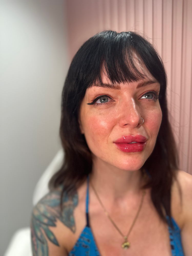 Lip & Chin Duo